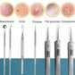 8pcs Ultra-fine Beauty Salon Acne Needle Tool Set